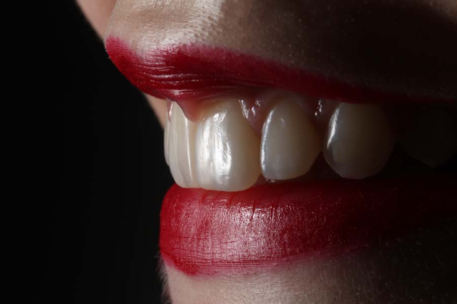 Diferencias entre la gingivitis y la periodontitis