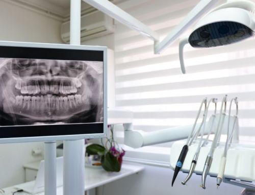Descubre qué son los microimplantes y sus utilidades