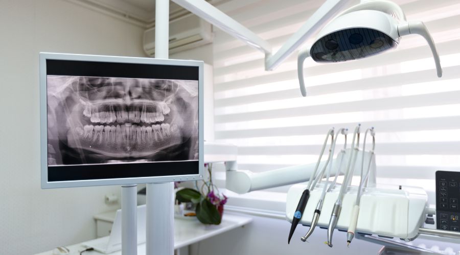 microimplantes