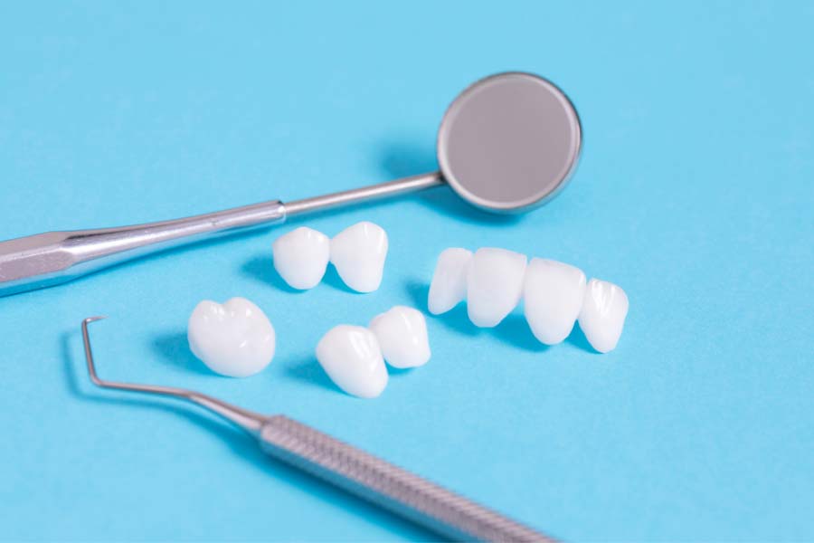 Las carillas dentales ayudan a reemplazar el esmalte dental