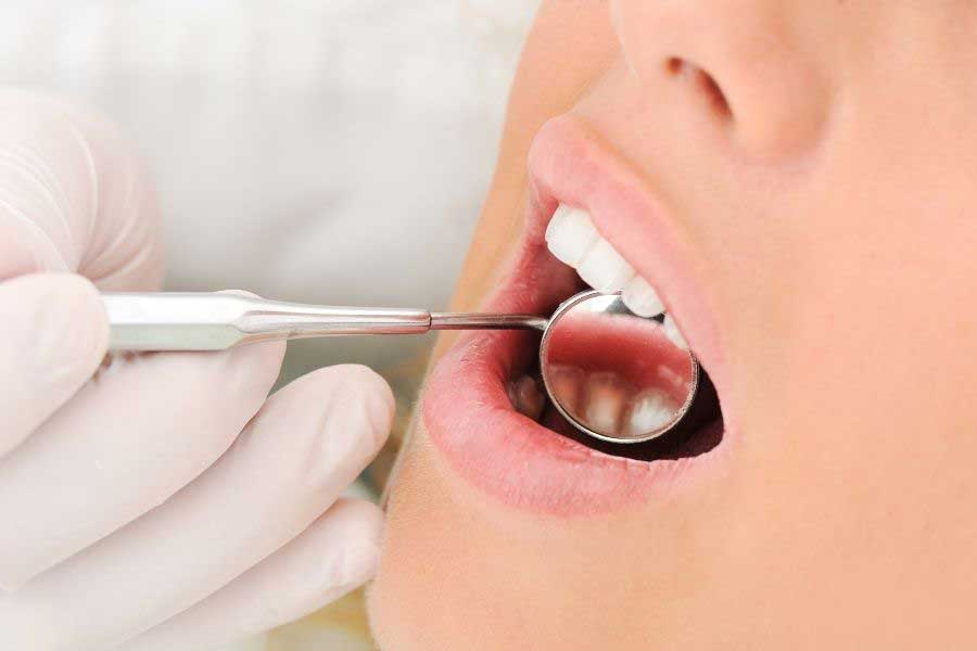 Detección de caries dental