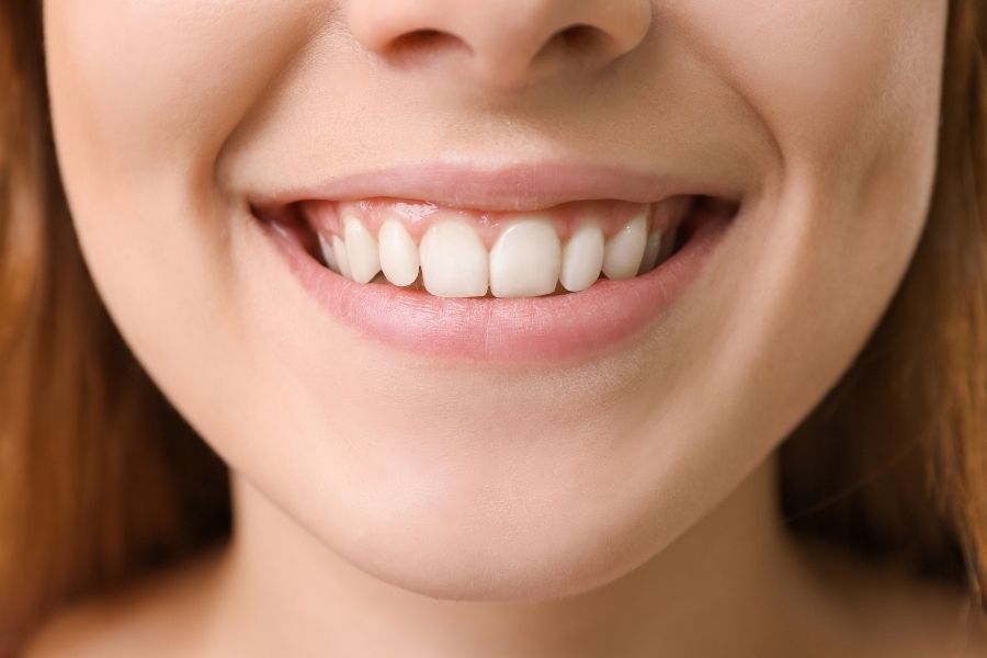 ¿Qué son los frenillos labiales y linguales?