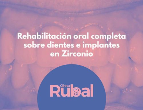 Rehabilitación oral completa sobre dientes e implantes en Zirconio