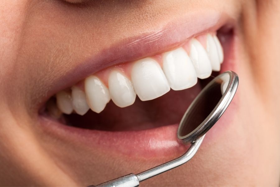Factores de riesgo de la candidiasis oral | Rubal Dental