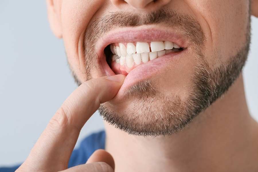 Síntomas de las fisuras dentales | Rubal Dental