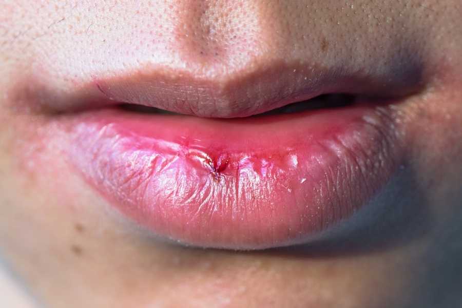 La importancia de la saliva | Rubal Dental