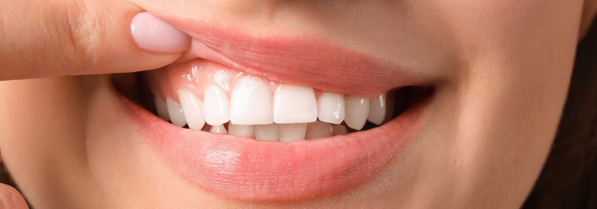 Periodoncia | Rubal Dental