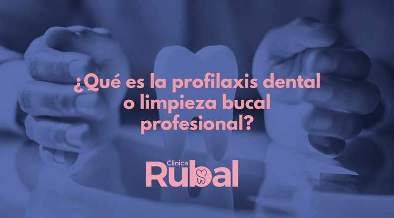 ¿Qué es la profilaxis dental o limpieza bucal profesional? | Rubal Dental