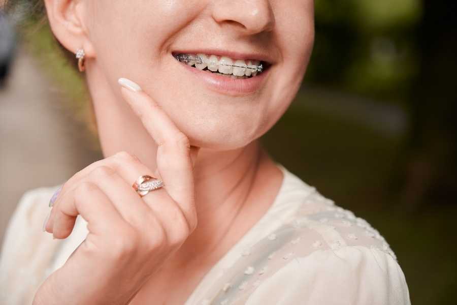 Tratamiento del apiñamiento dental | Rubal Dental