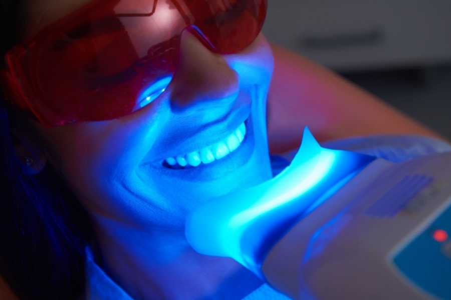 Blanqueamiento dental con luz LED