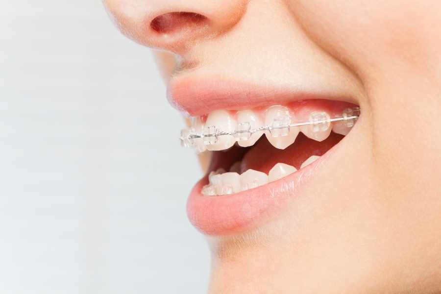 Tratamiento de ortodoncia de la deglución atípica