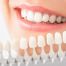 dientes blancos