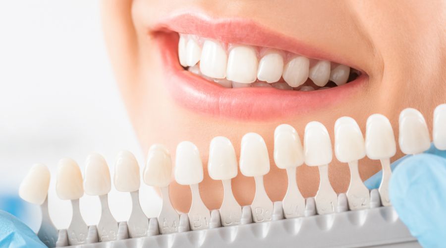 dientes blancos