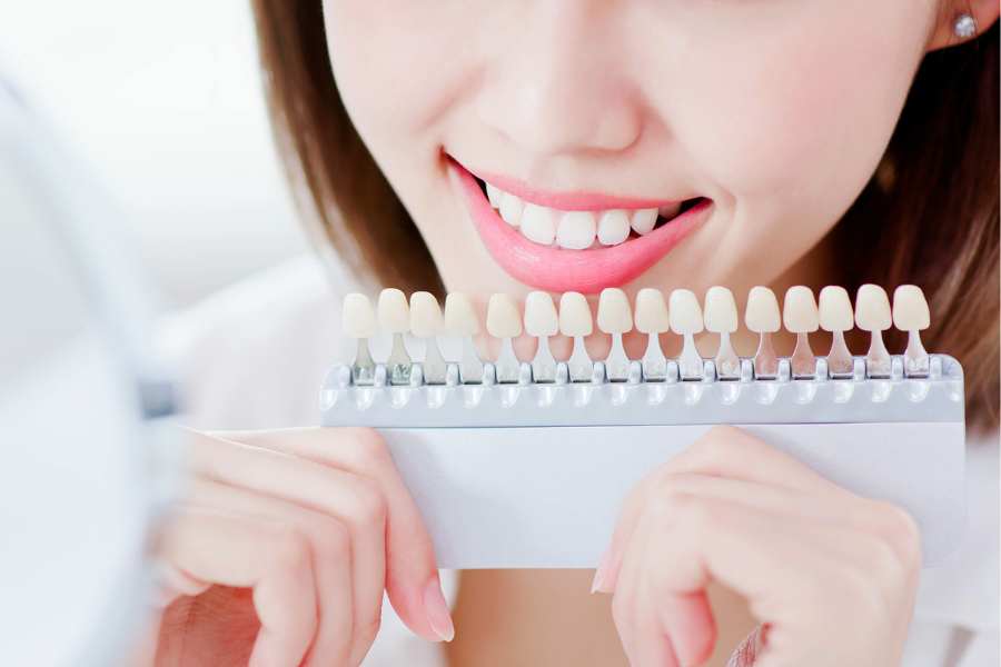 Escala de tonalidades de blancos en los dientes