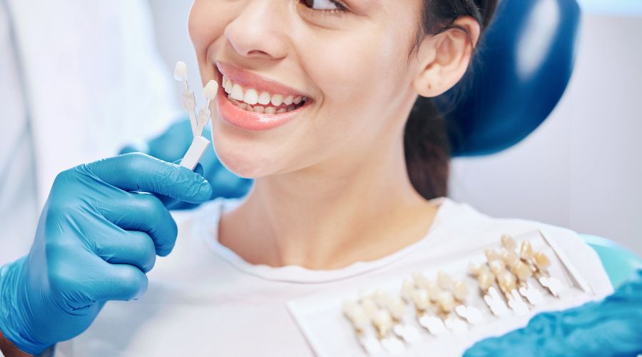 las carillas dentales son para siempre