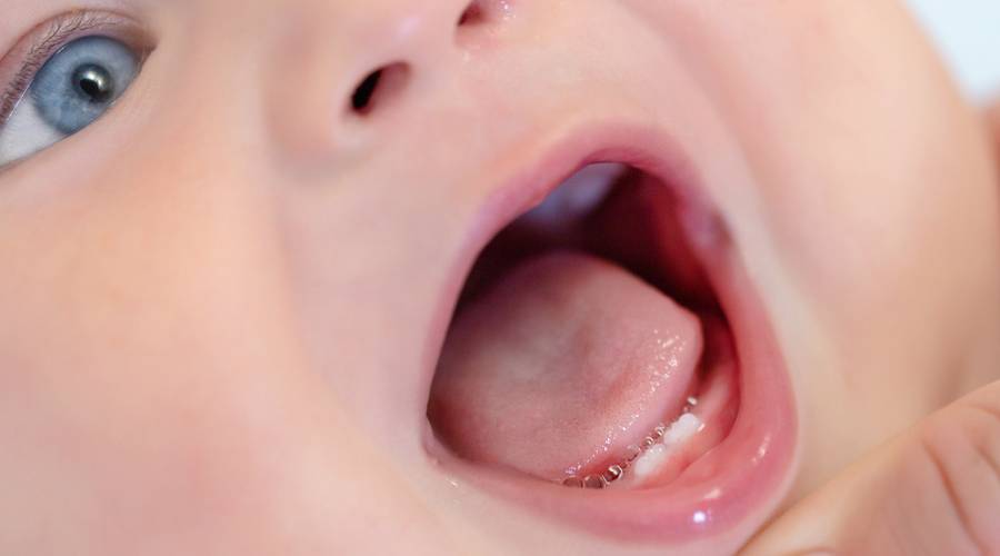 Dentición en bebés