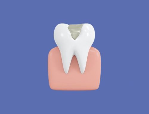 Empaste dental: qué es y cuánto se tarda en hacer