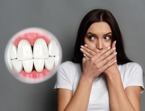 Troneras dentales: qué es y cómo eliminarlas