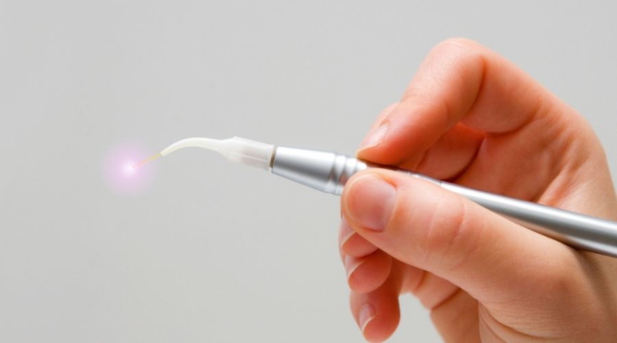 laser dental
