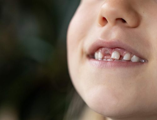 La dolencia dental que altera el tamaño de tus dientes y cómo tratarla