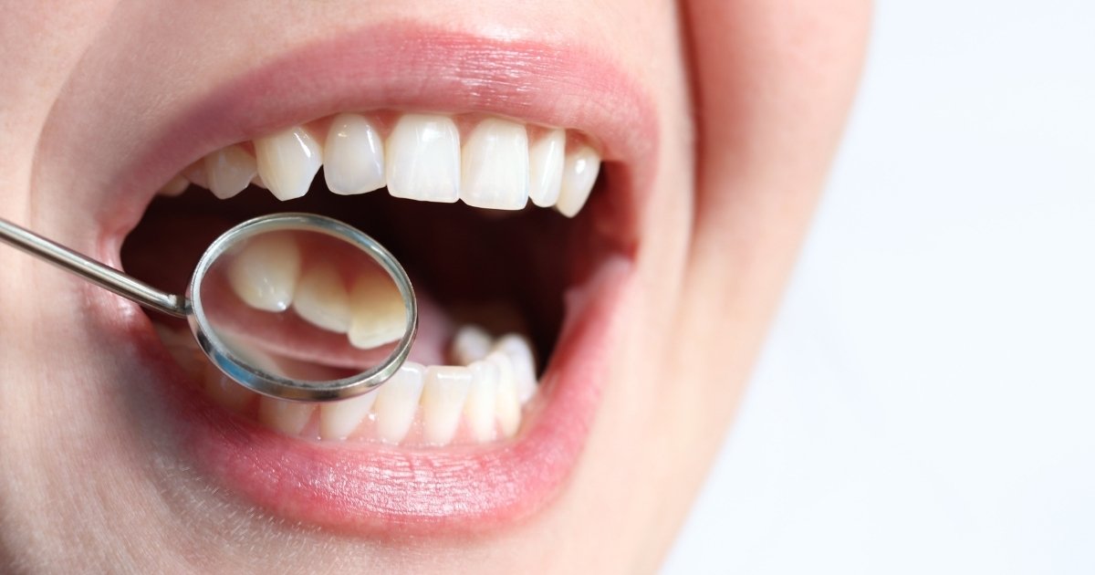 Eritroplasia control