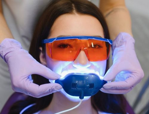 ¿El blanqueamiento dental duele? La verdad sobre la sensibilidad y cómo evitarla