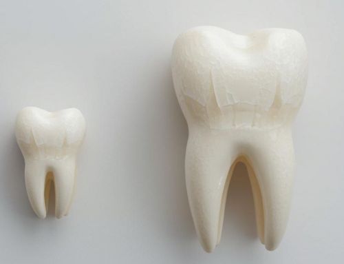 Microdoncia: qué es, causas y tratamientos