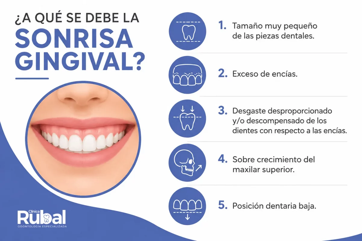 A qué se debe la sonrisa gingival