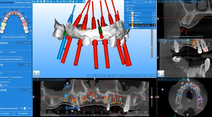 Tecnología 3D Estética Dental