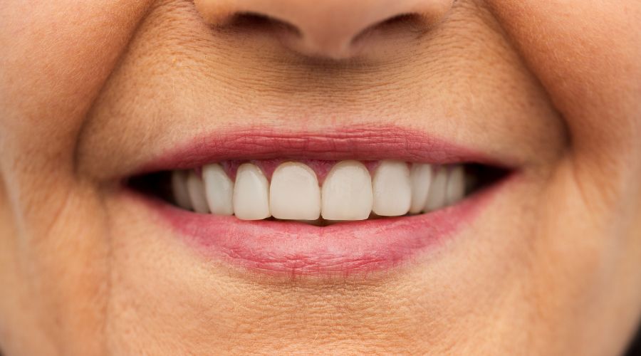 dientes postizos fijos