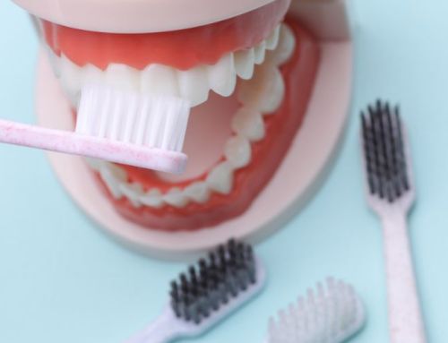 Dientes postizos fijos: qué opciones existen para recuperar toda la sonrisa